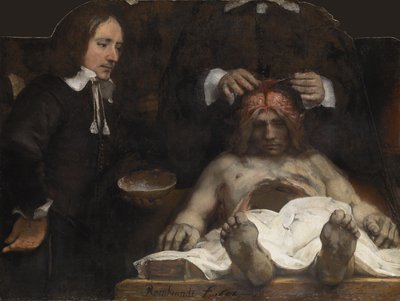 Die Anatomievorlesung des Dr. Jan Deyman, 1656 von Rembrandt van Rijn