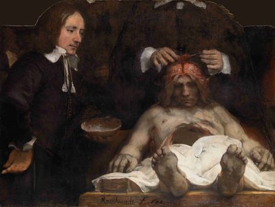 Die Anatomie-Lektion des Dr. Jan Deijman, 1656 von Rembrandt van Rijn