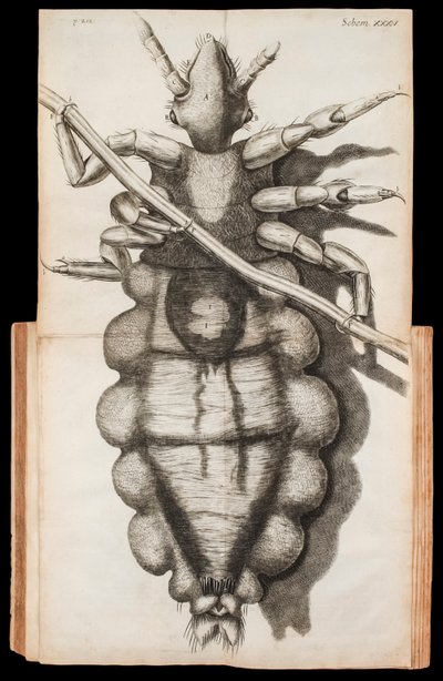 Ausklappbare Illustration einer Laus auf einem Haarstrang aus 