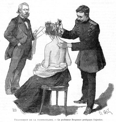 Professor Bergmann injiziert einem Tuberkulosepatienten, 1891 von Unbekannt