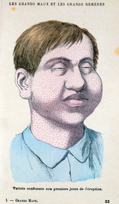 Pockenopfer von Unbekannt