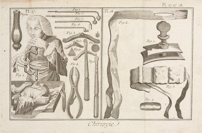 Trepanation von Unbekannt