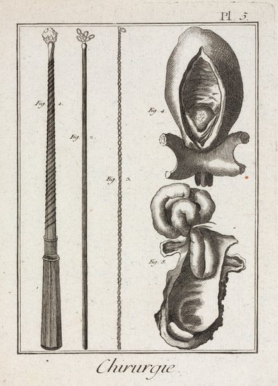 Ausrüstung, frühmoderne chirurgische Instrumente und Diagramme von Körperteilen von Unbekannt