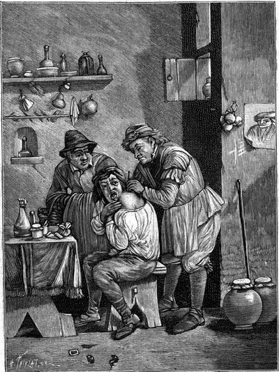 Ein Scharlatan-Chirurg im 18. Jahrhundert untersucht eine Schulterverletzung. (Nach einer Gravur der Zeit). Gravur in „La Nature: revue des sciences et de leurs applications aux arts et a l