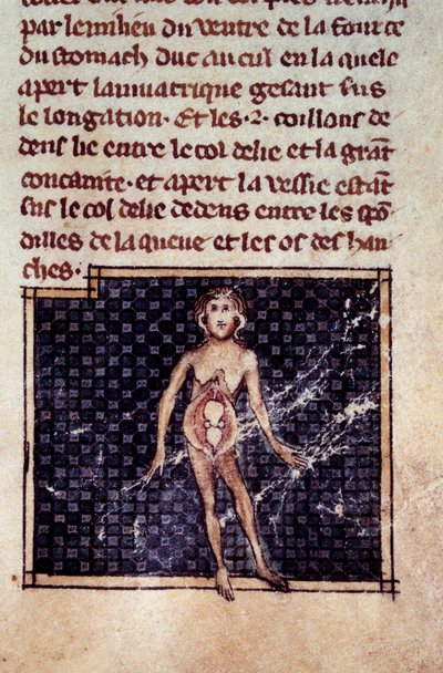 Anatomische Figuren: männliche und weibliche Körper, geöffneter Bauch, Detail der Frau. Miniatur aus dem Manuskript „Chirurgie“ von Henri de Mondeville von Unknown artist