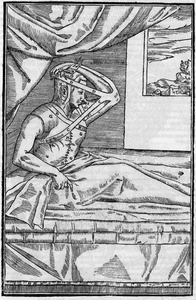 Nasenchirurgie: Rekonstruktive Chirurgie an der Nase in „De curtorum chirurgia per insitionem“. Venedig von Unknown artist
