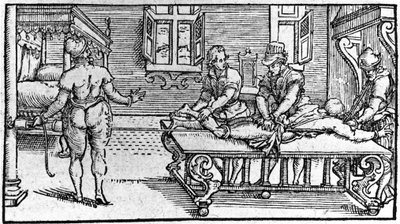 Reduktion einer Luxation, in „Traitè Médical“ von Ambroise Paré, um 1560 von Unknown artist