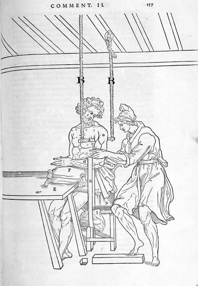 Reduktion von Frakturen. Illustrierte Tafel aus „De dissectione partium corporis humani libri tres...“ von Carlo Stefano Riverio, Paris 1545 von Unknown artist