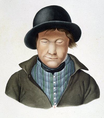 Aussätzige von Island, um 1840, B.N. von Unknown artist