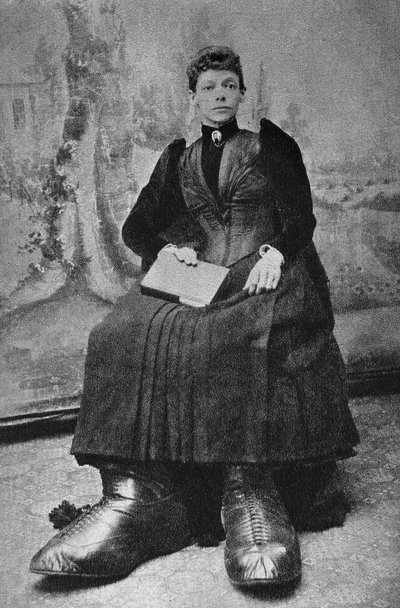 Die Monster, Berthe mit den großen Füßen. Fotografie, späte 19. Jahrhundert, Paris. Sammlung Selva. von Unknown photographer