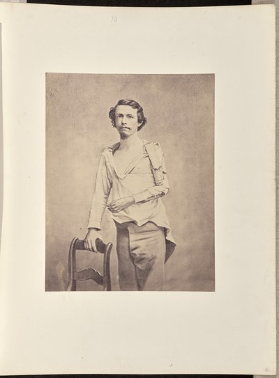 Erfolgreiche Exzision des Kopfes des linken Humerus, gefolgt von Nekrose und sekundärer Exzision des restlichen Humerus und der oberen Extremitäten des Radius und der Ulna von William H. Bell