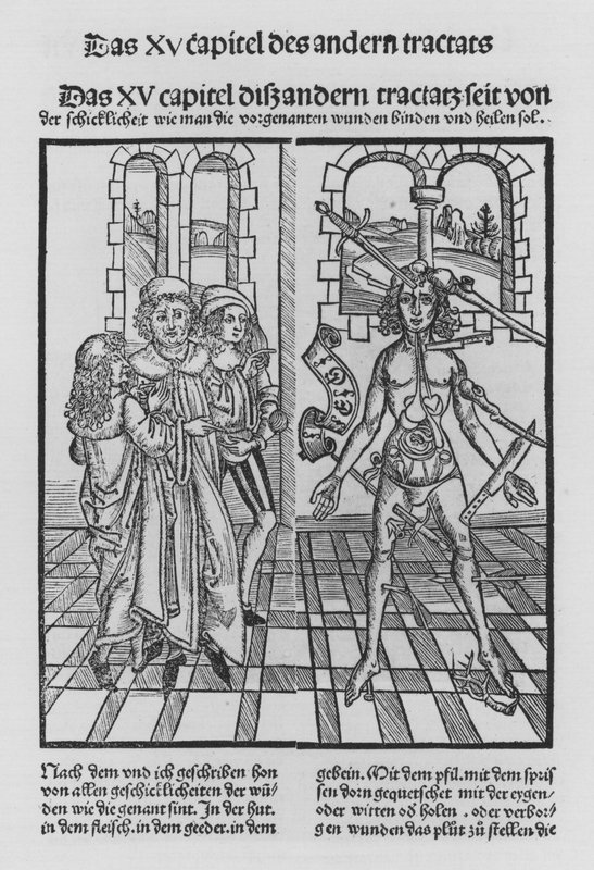 Das Buch der Chirurgie von Hieronymus Brunschwig von (after) German School