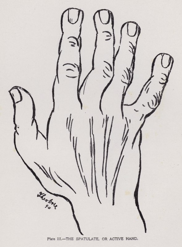 Die spatelförmige oder aktive Hand (s/w Foto) von English Photographer