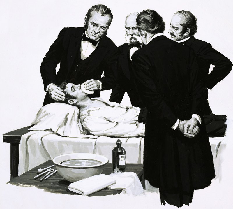 Dr. Crawford Long macht einen Studenten bewusstlos, bevor er eine Operation durchführt von English School