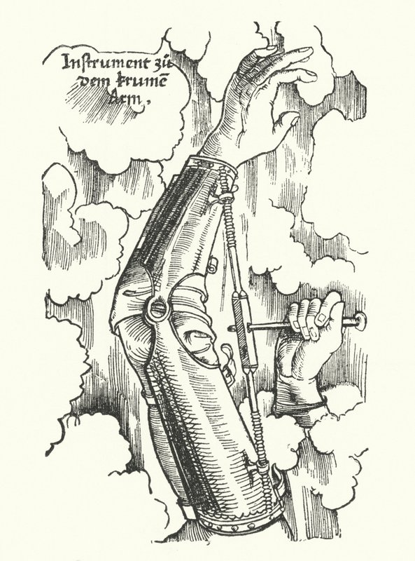 Instrument zur Behandlung eines verletzten Arms (Gravur) von German School