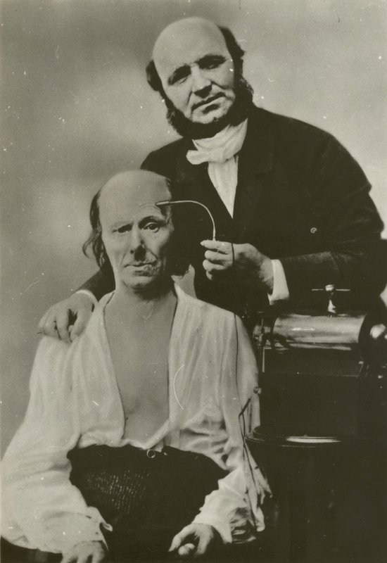 Französischer Neurologe Duchenne de Boulogne benutzt sein Elektrophysiologie-Apparat an einem alten Mann von Guillaume Benjamin Armand Duchenne de Boulogne