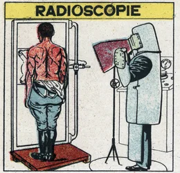 Röntgenstrahlen: Radioskopie eines menschlichen Körpers. Der Radiologe schützt sich vor Röntgenstrahlen, indem er ein Gummituch mit einer Gummilösung, die Bleisalze enthält, trägt. Sein Kopf ist mit einer Kappe bedeckt und seine Hände mit Handschuhen aus d