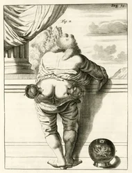 Ein Beispiel für Schröpfen, aus Exercitationes Practicae circa Medendi Methodum von Frederik Dekkers, 1694
