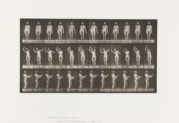 Tafel 557. Lokale Chorea; A, B, C, im Stehen, 1885