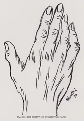 Die knotige oder philosophische Hand (s/w Foto)