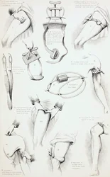 Methoden zur Blutstillung, um 1890
