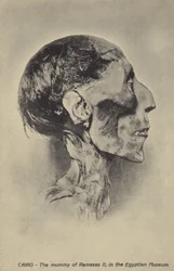 Mumie von Ramses II.