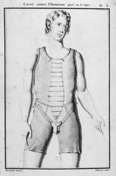 Korsett zur Verhinderung der Onanie, Illustration aus „Traité des bandages et appareils“ von J. B. J. Thillaye, Paris, veröffentlicht 1815