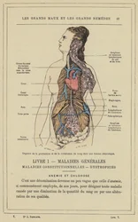 Organe der Blutproduktion und -zirkulation bei einer chlorotischen Frau