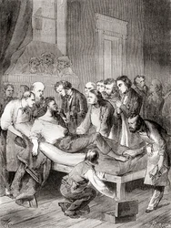 Die erste öffentliche Demonstration der Verwendung von inhaliertem Äther als chirurgisches Anästhetikum im Jahr 1846 durch einen amerikanischen Zahnarzt, William Thomas Green Morton, aus 