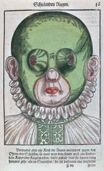 Maske zur Behandlung eines Strabismus, aus Ophthalmodouleia von Georg Bartisch (1535-1636) veröffentlicht in Dresden 1583 (Farbholzschnitt)