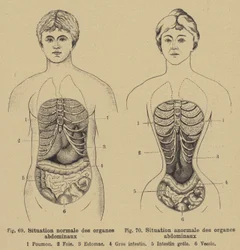 Normale Lage der inneren Organe des Bauches bei Männern und Frauen