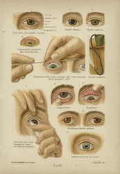 Das Auge