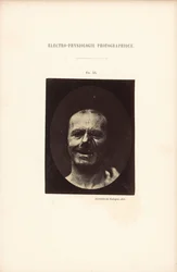 Elektro-Physiologie Fotografisch, Figur 53