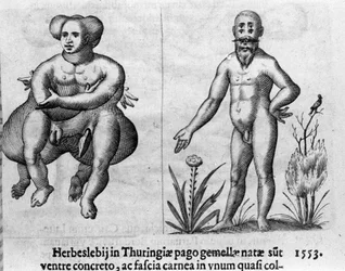 Verschiedene Arten menschlicher Monster. Stich aus „De monstrorum natura, causis et differentiis“ von Fortunio Liceti (1577-1656), italienischer Wissenschaftler. 1646