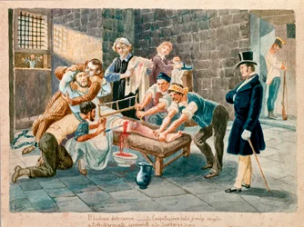Dem Patrioten und Mitglied der Carbonari Pietro Maroncelli (1795-1846) wurde während seiner Haft im Zuchthaus der Festung Spielberg in Mähren ein Bein amputiert. Druck aus dem 19. Jahrhundert, Museo del Risorgimento, Mailand
