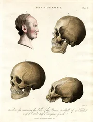 Physiognomie – Schädel verschiedener Ethnien