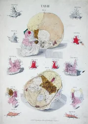 Knochen des Schädels, aus 