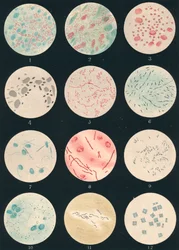 Bakterien, 19. Jahrhundert