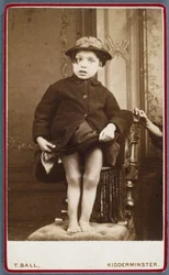 Krankheiten, Rachitis Kind mit Rachitis