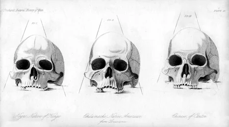 Drei Typen menschlicher Schädel, 1848