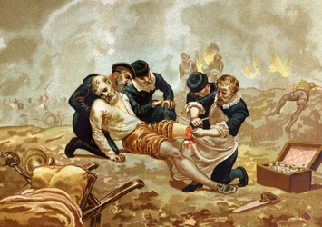 Ambroise Pare Arzt und französischer Chirurg (ca. 1509-1590) praktiziert die Ligatur von Arterien nach der Amputation. aus „Hombres y Mujeres celebres“. Barcelona 1877.