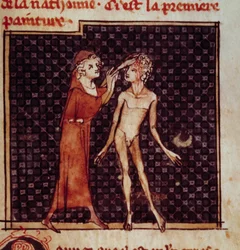 Anatomische Figur: Der Chirurg schneidet die Stirn eines Patienten auf. Miniatur aus dem Manuskript „Chirurgie“ von Henri de Mondeville