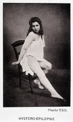 Hystero Epilepsie - Kontraktur in „Photographische Ikonographie der Salpêtrière: Dienst von Herrn Charcot“ von Paul Regnard und Bourneville