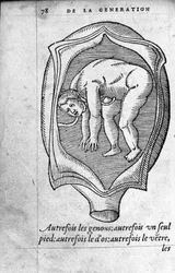 Die Position des Fötus im Uterus während der Schwangerschaft. Gravur aus „De la generation des enfants“ von dem französischen Arzt und Chirurgen Ambroise Pare (1509-1590) 16. Jahrhundert