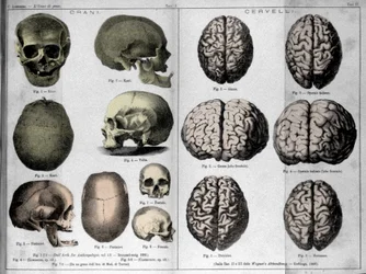 Die Häute und Gehirne von Genies. Studie von Cesare Lombroso (1835-1909), italienischer Kriminologe in „Der Mann des Genies“