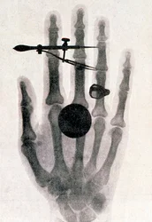 Wilhelm Röntgens Röntgenaufnahme der Hand seiner Frau, 1896
