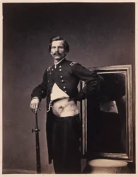 Major H. A. Barnum, Genesung nach einer durchdringenden Schusswunde des Bauches mit Perforation des linken Iliums, aus dem fotografischen Katalog der chirurgischen Abteilung