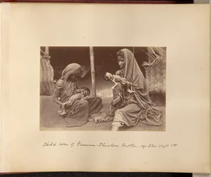 Kind einer hungernden Mutter geboren - Alter: 3 Monate, Gewicht: 3 Pfund.