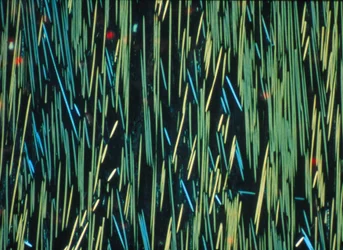Verbundwerkstoff, LM PMC Kohlefaser in einer Polymermatrix